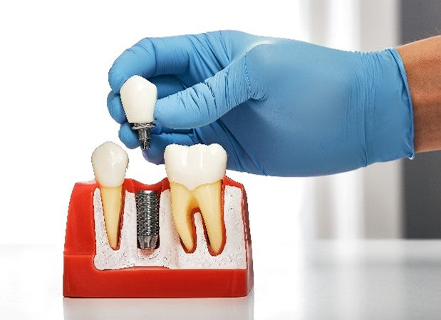 What is a dental crown?