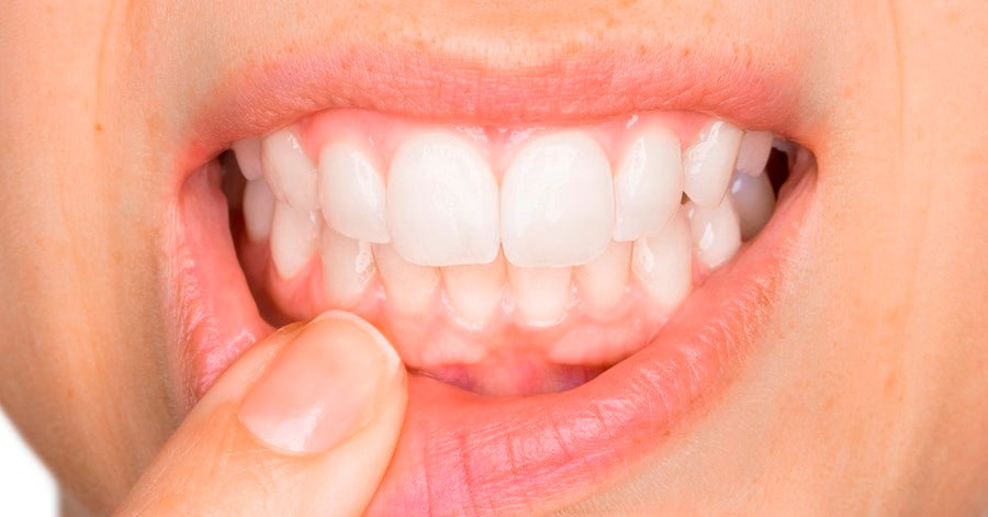 Guide to Preventing Gum Disease and Cavities