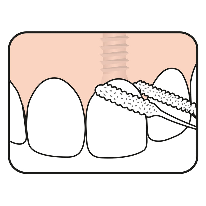 TePe Bridge and Implant Floss